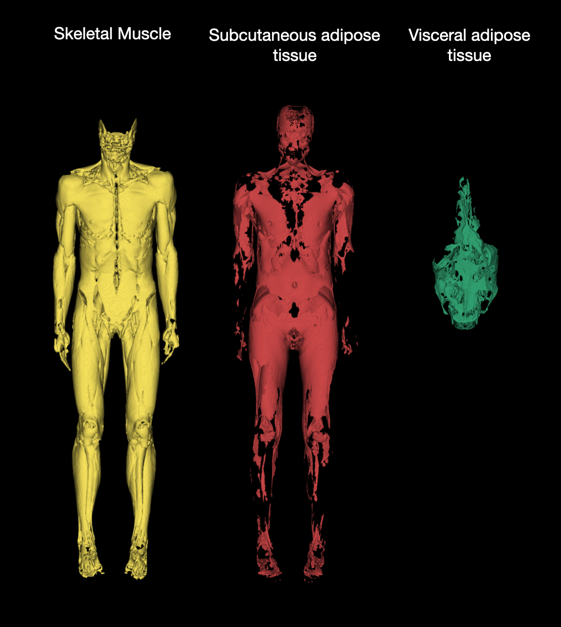 3D visualization of tissue segmentation